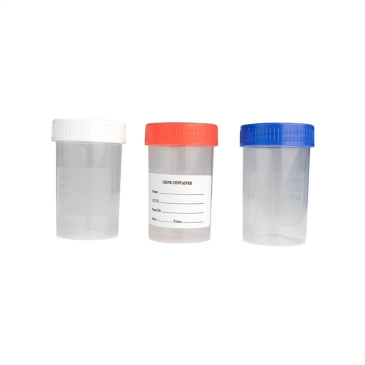 China Customized Sterile Plastic Urine Container Urine Cup 30ml 40ml