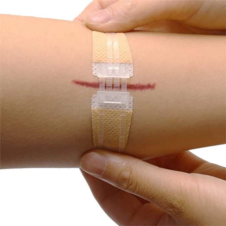 China Customized Adhesive Butterfly Bandages Emergency Zipper Suture